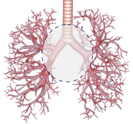 Lung lesions