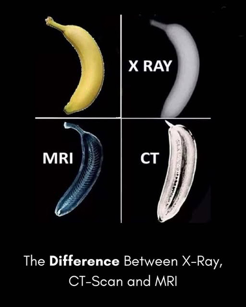 MRI and x-ray